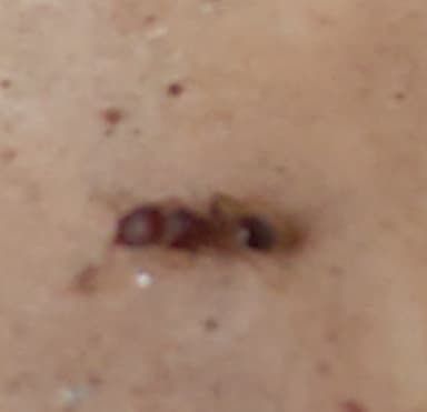 Tetramorium lanuginosum photo 34